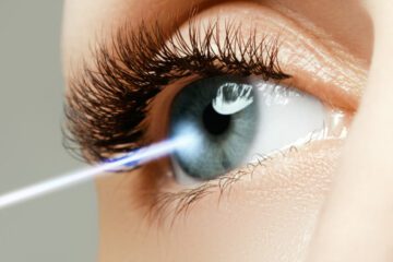 Krankenversicherung – Augenoperation mit Femto-Laser – Kostenerstattungsanspruch