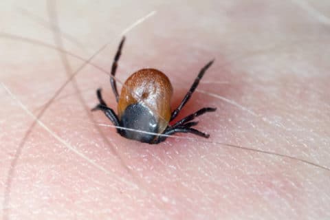 Unfallversicherung - Infektion durch Zeckenbiss versichert?