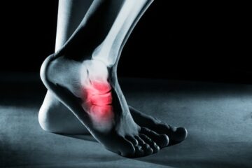Unfallversicherung – Versteifung des Fußgelenks aber noch verbleibenden Restfunktionen des Fußes