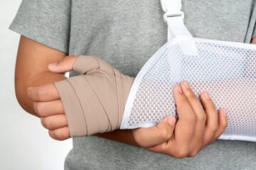 Unfallversicherung – Verlust oder Funktionsunfähigkeit einer Hand