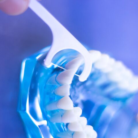 Kostenübernahme für Invisalign